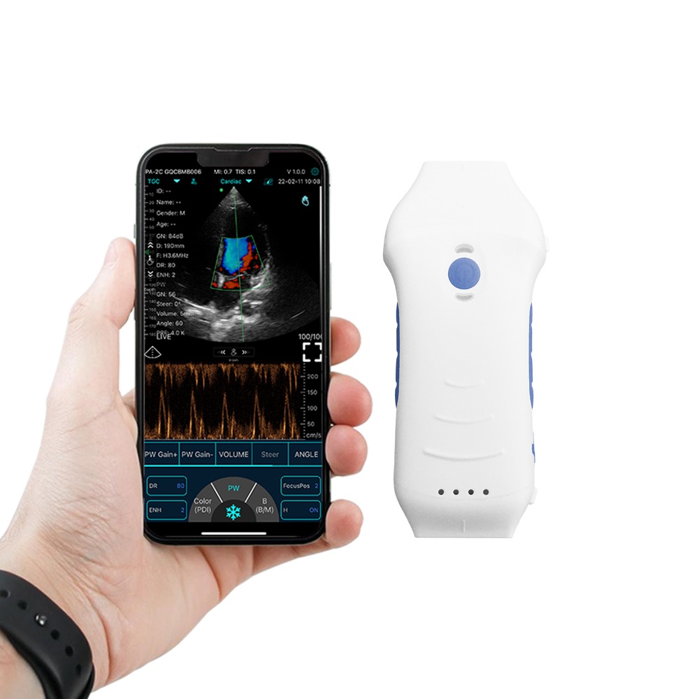 WIRELESS ULTRASOUND SCANNER